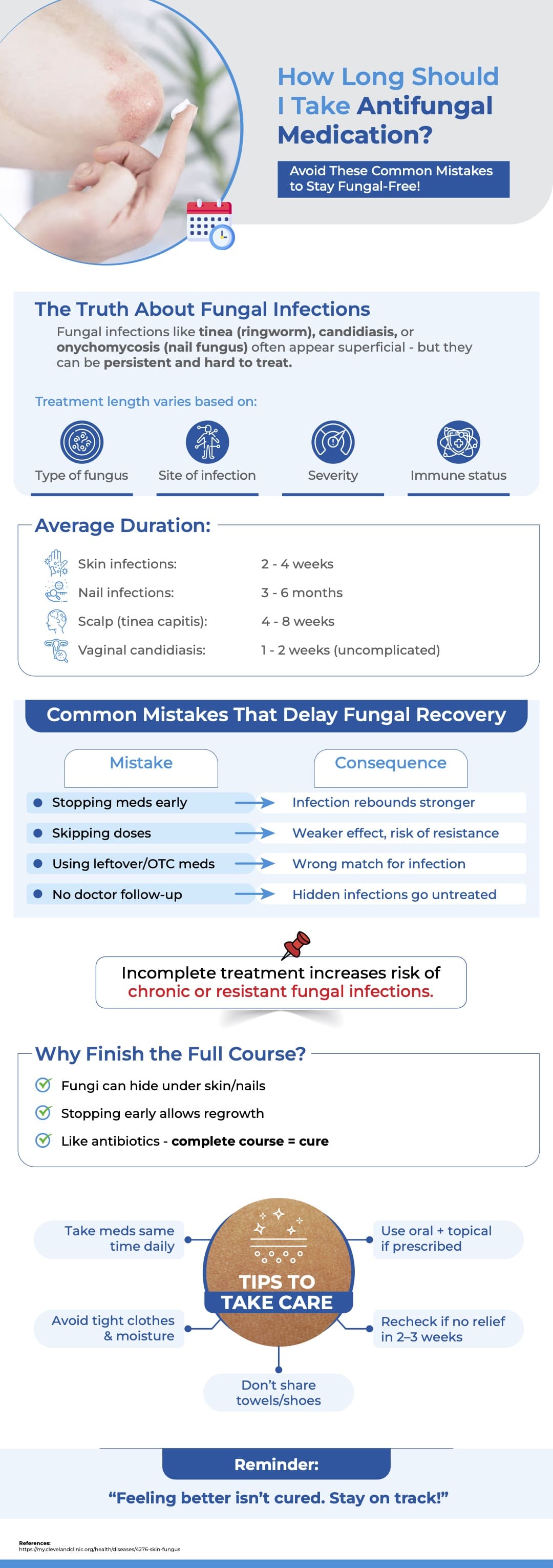 How long should I take Antifungal Medication Blog image